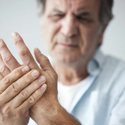 Arthritis &#8211; Early Signs and Natural Treatments