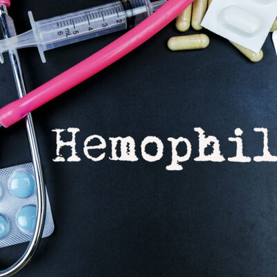 Early Warning Signs and Symptoms of Hemophilia