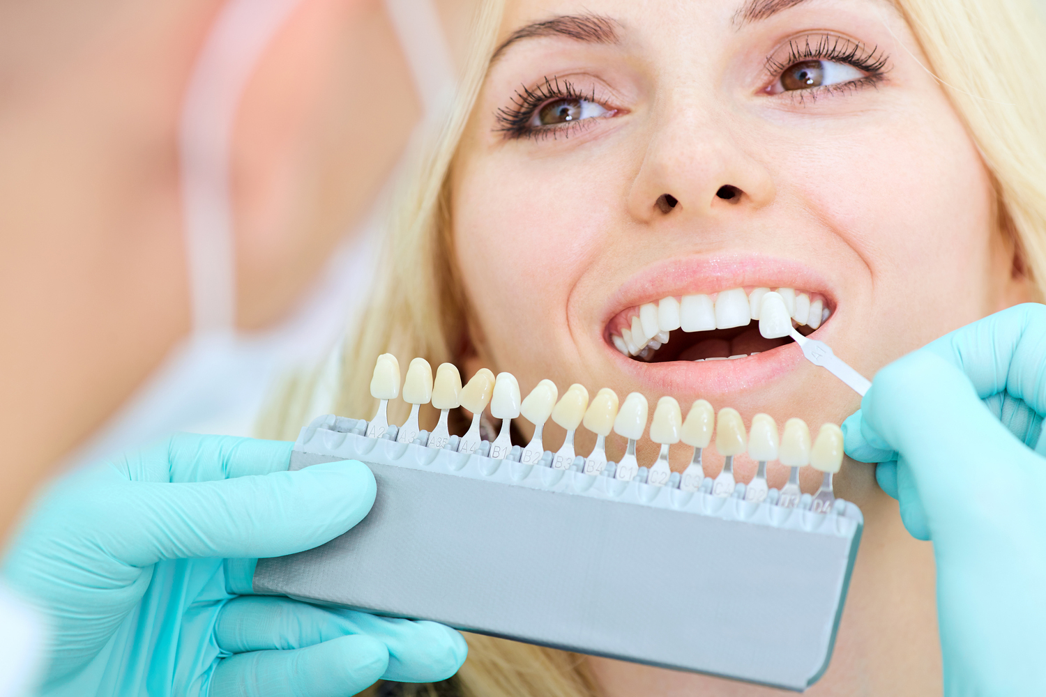 Dental Implant Cost: Instant Ways to Save on Dental Implants