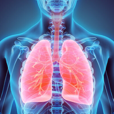 What Is Mac Lung Disease and How is it Contracted?